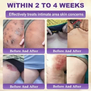Nuvelliana Biotin 10-in-1 Skin Restoration Cream