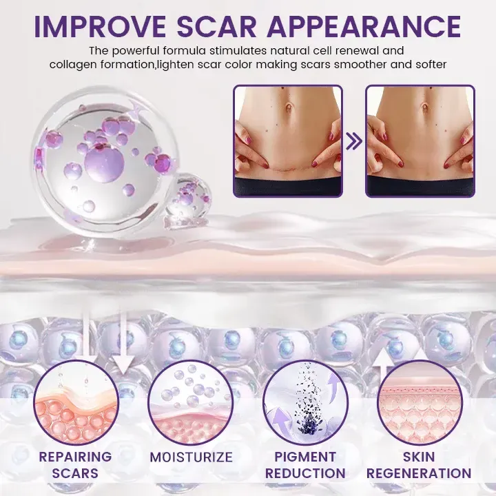 Nuvelliana Regenscar Stem Cell Scar Gel