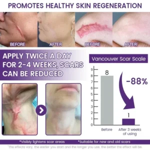 Nuvelliana Regenscar Stem Cell Scar Gel
