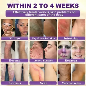 Nuvelliana Biotin 10-in-1 Skin Restoration Cream