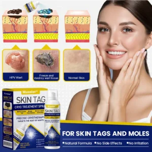 Musster Skin Tag Cryo Treatment Spray