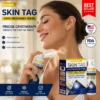 Musster Skin Tag Cryo Treatment Spray